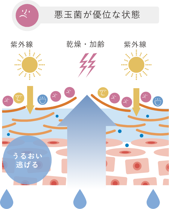 悪玉菌が優位な状態